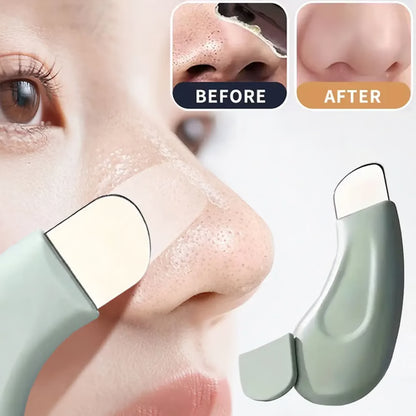 Blackhead Remover Tool – Deep Facial Pore Cleansing