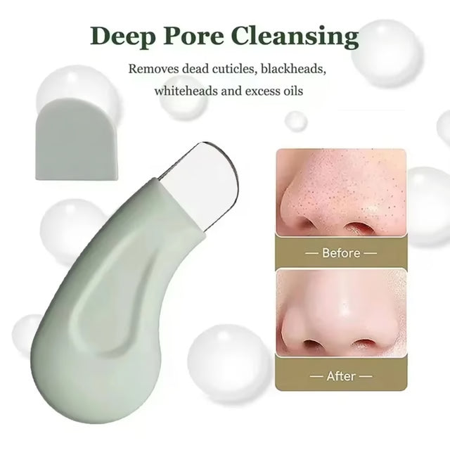 Blackhead Remover Tool – Deep Facial Pore Cleansing